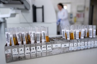 Ist es ein Problem, wenn ich meine Blutgruppe nicht kenne? - Blut ist nicht gleich Blut: Entscheidend für die Einsortierung in eine Blutgruppe ist, welche Antigene sich auf der Hülle der roten Blutkörperchen befinden.