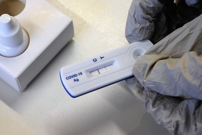 Realität derzeit für viele Chemnitzerinnen und Chemnitzer: Zwei Streifen auf der Corona-Schnelltestkassette bedeuten ein positives Ergebnis. Mehr als 3500 Einwohnerinnen und Einwohner haben sich seit vergangenem Samstag mit dem Virus angesteckt. Die Inzidenz hat am gestrigen Freitag ein Rekordhoch erreicht. 