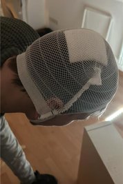 Das Foto hat Emely S. von ihrem Freund nach dem Überfall auf ihre Wohnung gemacht, gibt sie an.