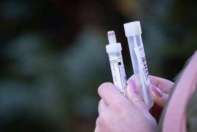 Eine Frau hält Zubehör für einen Coronatest in den Händen. 