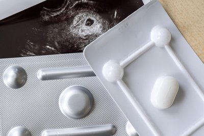 Medikamente zum Schwangerschaftsabbruch sind in einer gynäkologischen Praxis vor einem Ultraschallbild: Werden die Abbrüche bald im Schwangerschaftskonfliktgesetz geregelt?