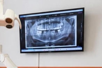 Zunehmend geht es bei der Zahnmedizin um ästhetische Zahnheilkunde.