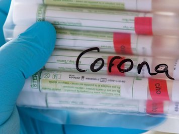             Proben für Corona-Tests werden für die weitere Untersuchung vorbereitet.