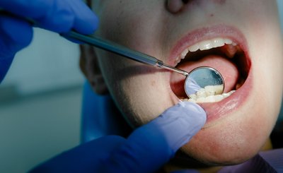 Und aaaah: Wer mit der Regelversorgung der Krankenversicherung zufrieden ist, benötigt nicht unbedingt eine Zahnzusatzversicherung.