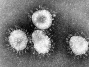 So sieht ein Coronavirus unter dem Mikroskop aus.