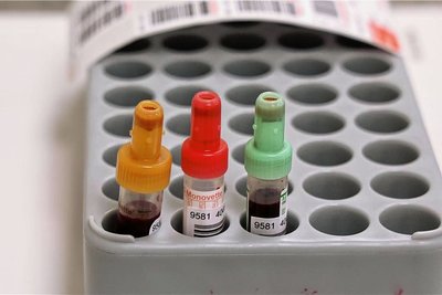 Die Sprechstunde für Kinderbluterkrankungen in Meerane umfasst die Labordiagnostik, Aufklärungsgespräche und Langzeitbehandlungen.