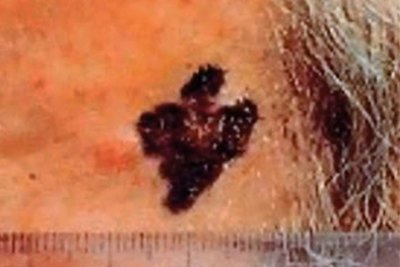 Deutsche Krebsgesellschaft