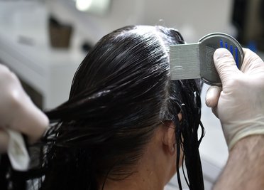 Gründliche Untersuchung ist entscheidend: Mit einem Läusekamm und einer Haarspülung lassen sich Läuse und Eier im feuchten Haar am zuverlässigsten aufspüren.