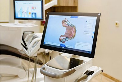 Ein Oralscanner mit eingescanntem Gebiss.