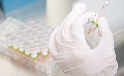 PCR-Tests im Labor.