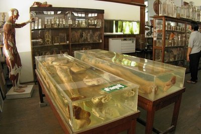 Nichts für Zartbesaitete: Exponate im Siriraj Medical Museum im thailändischen Bangkok. 