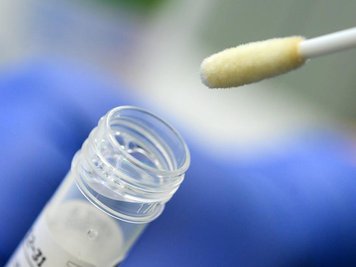            Ein Abstrich für das Testverfahren auf das Coronavirus.