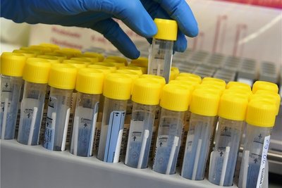 Nach dem positiven PCR-Test werden die Betroffenen im Vogtland in der Regel per SMS direkt vom Labor kontaktiert. 