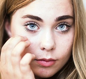  Unter dem Auge liegt der Stresspunkt. Ihn zu klopfen, hilft Alisia, Stress abzubauen. 