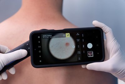 Die „Dicom Camera“ dient zum Beispiel der Haut- und Wunddokumentation.