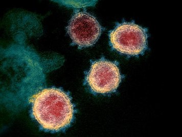            Elektronenmikroskopische Aufnahme zeigt das Virus, das COVID-19 verursacht.