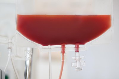 2023 wurde bei der Frau Leukämie diagnostiziert. Nur eine Stammzellenspende konnte sie retten.