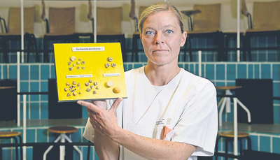 Nicole Schwerdtfeger vom Institut für Pathologie der Dresdner Uniklinik zeigt, wie verschiedene Gallensteine aussehen können.