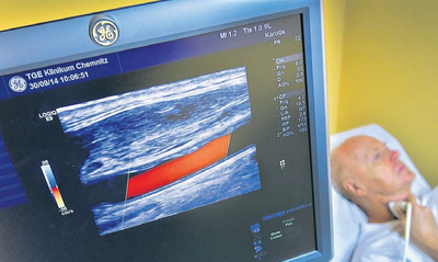 Die Ultraschallaufnahme in der Klinik für Gefäßchirurgie am Klinikum Chemnitz zeigt, dass die große Halsschlagader des Patienten wieder komplett durchgängig ist. Die rote Farbe kennzeichnet den kräftigen Blutstrom in der Arterie.