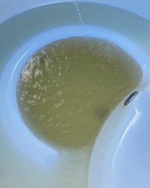 Wie trüb das Wasser in den Häusern am Freitaggut läuft, zeigt dieses Bild. 