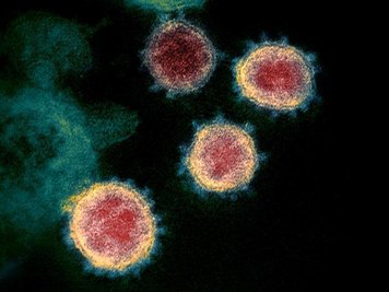 Eine elektronenmikroskopische Aufnahme zeigt das Virus, das Covid-19 verursacht.