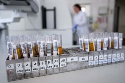 Blut ist nicht gleich Blut: Entscheidend für die Einsortierung in eine Blutgruppe ist, welche Antigene sich auf der Hülle der roten Blutkörperchen befinden.