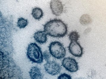             Elektronenmikroskopische Aufnahme zeigt das neuartige Coronavirus SARS-CoV-2.