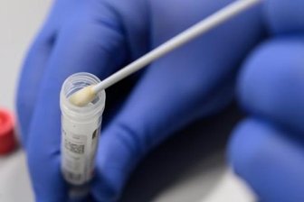 7-Tage-Inzidenz steigt im Erzgebirgskreis auf über 300 -