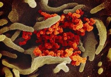 Eine undatierte elektronenmikroskopische Aufnahme des «U.S. National Institute of Health» zeigt das neuartige Coronavirus (SARS-CoV-2) (orange), das aus der Oberfläche von im Labor kultivierten Zellen (grau) austritt. 