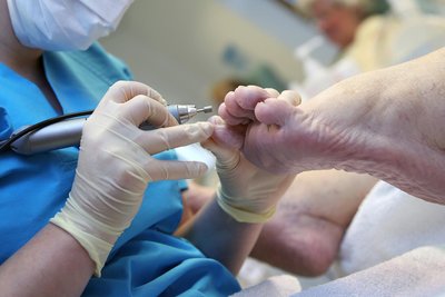 Podologie ist nicht-ärztliche Heilkunde am Fuß. Der Bedarf nach dieser Leistung steigt immer mehr aufgrund einer immer älteren Bevölkerung und Krankheitsbildern wie Diabetes.