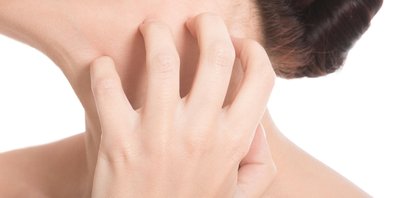 Juckreiz lässt Neurodermitiker verzweifeln. 