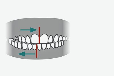 Grafik: Satztechnik Meißen 