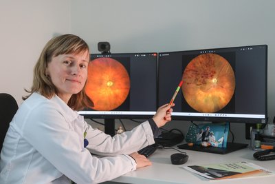 Links alles in Ordnung, rechts Flecke wie vom verschütteten Rotwein: Privatdozentin Dr. Olga Furashova zeigt, wie eine Blutung im Auge aussehen kann.