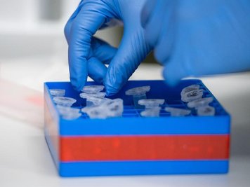 Eine Laborantin führt Untersuchungen zum Coronavirus durch.