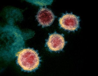 Undatierte elektronenmikroskopische Aufnahme, die von den U.S. National Institutes of Health im Februar 2020 zur Verfügung gestellt wurde, zeigt das Virus, das Covid-19 verursacht