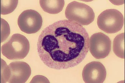 Nicht zu verwechseln mit dem ähnlichen segmentkernigen Granulozyt, eine Zelle der Immunabwehr. Die Ringe sind rote Blutzellen. 