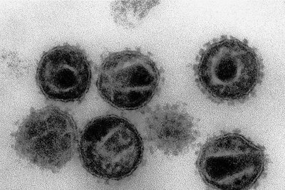 Elektronenmikroskopaufnahme von HI-Viren, den Erregern der Krankheit Aids.
