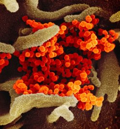 Der Coronavirus legt das Vogtland lahm. Zwei Fälle waren bis Montagabend für den Landkreis bestätigt. Die Illustration zeigt eine elektronenmikroskopische Virus-Aufnahme des "U.S. National Institute of Health". 