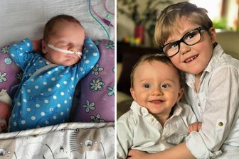 Acht Wochen zu früh in Mittweida auf die Welt gekommen: So geht es Vincent heute - Vincent im Alter von zwei Wochen im Krankenhaus Mittweida (links) und jetzt, mit seinem älteren Bruder.