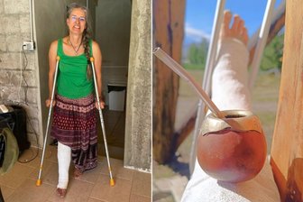 Allein durch die Anden: Warum ein Beinbruch für eine Frau aus Naundorf kein Beinbruch ist - Solveig Schmidt aus Naundorf hat sich auf ihrem Weg durch die Anden ein Bein gebrochen. Sie lässt sich davon nicht unterkriegen – sie legt das Gipsbein hoch und stellt die Kalebasse mit Mate darauf.