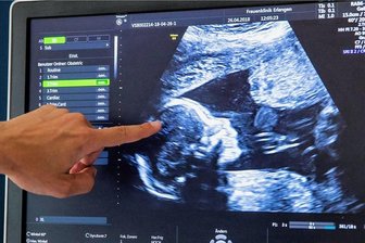 Als Selbstzahler beim Arzt: Nur zwei von 55 IGeL empfehlenswert - Gehört zu den am häufigsten genutzten IGeL-Leistungen: Eine Ultraschalluntersuchung während der Schwangerschaft zusätzlich zu den von den Kassen bezahlten Checks.