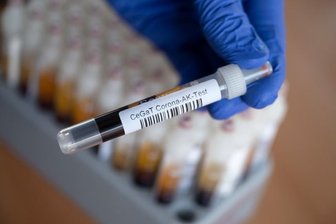 Antikörper hält alle Formen von Covid in Schach - 