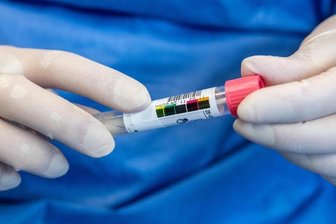 Anzahl der Corona-Fälle in Chemnitz steigt auf 16 -