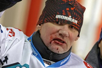 Bei Heimspiel der Eispiraten Crimmitschau: Puck trifft Eishockey-Fan voll im Gesicht - Kurz nach dem Pucktreffer bei der Partien zwischen Crimmitschau und Rosenheim: Torsten Stöber aus Lichtenstein blutet im Gesicht.
