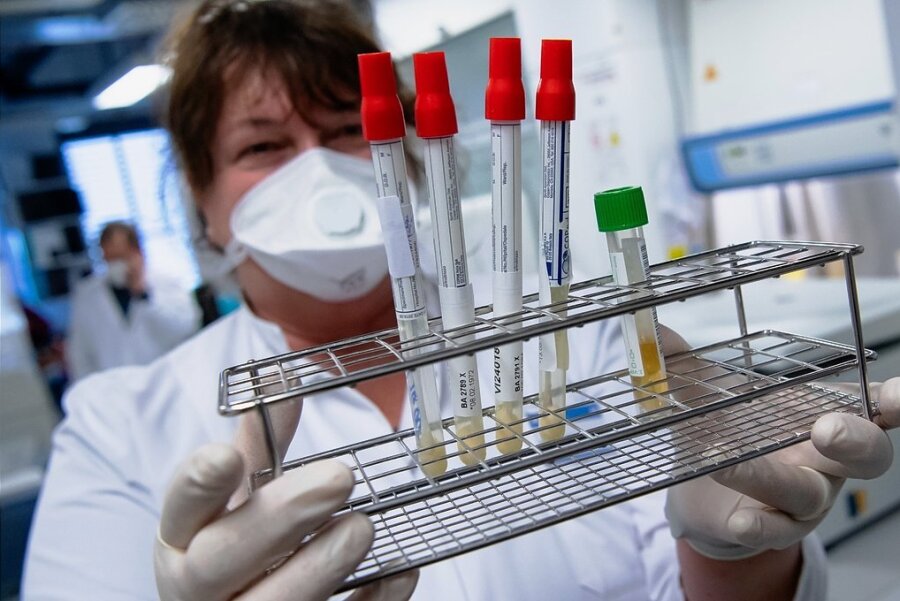 Biontech entwickelt Frühalarm für Risikovarianten - Eine Mitarbeiterin am Institut für Virologie der Technischen Universität München bereitet im Labor Coronaproben zur Analyse vor. 