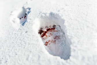 Blutspuren im Schnee: Spaziergängerinnen im Rabensteiner Wald schockiert - Spaziergänger entdeckten am Chemnitzer Stadtrand Blutspuren im Schnee.