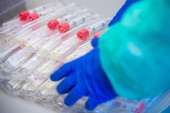 Testsets mit Abstrichstäbchen liegen in einem Testzentrum für Corona-Verdachtsfälle.