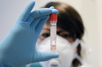 Corona: 82 Infektionsfälle im Vogtland - Im Vogtlandkreis sind inzwischen 80 bestätigte Covid-19-Fälle bekannt.