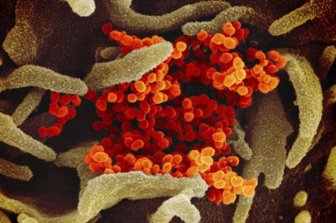 Corona: Die Lage im Vogtland am Montag - Coronavirus