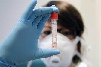 Corona-Epidemie: Zwölf neue Fälle am Mittwoch in Reichenbach - 